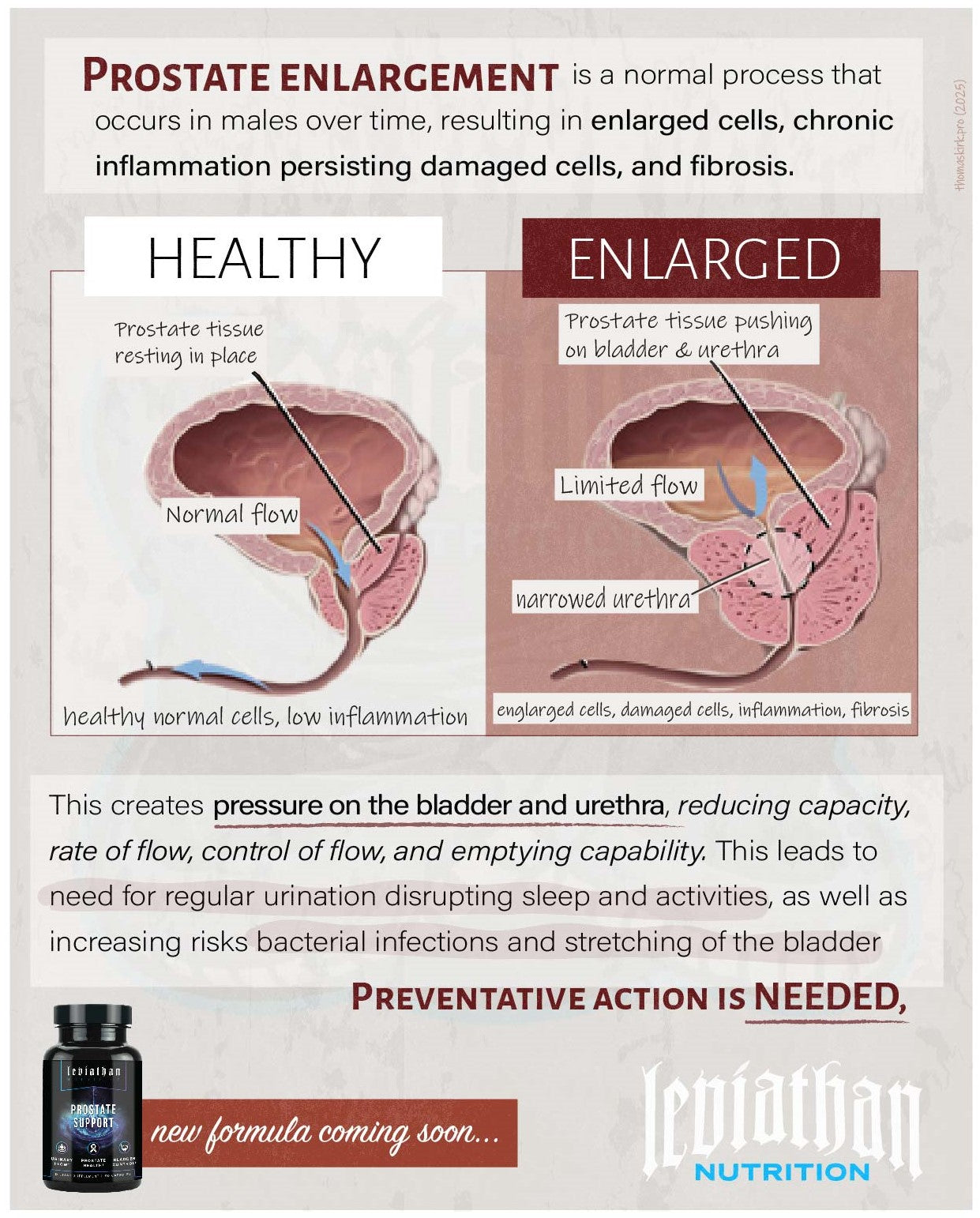 Diagram comparing healthy and enlarged prostate tissue with text about prostate enlargement and a supplement brand | Strom Sports Supplements NZ